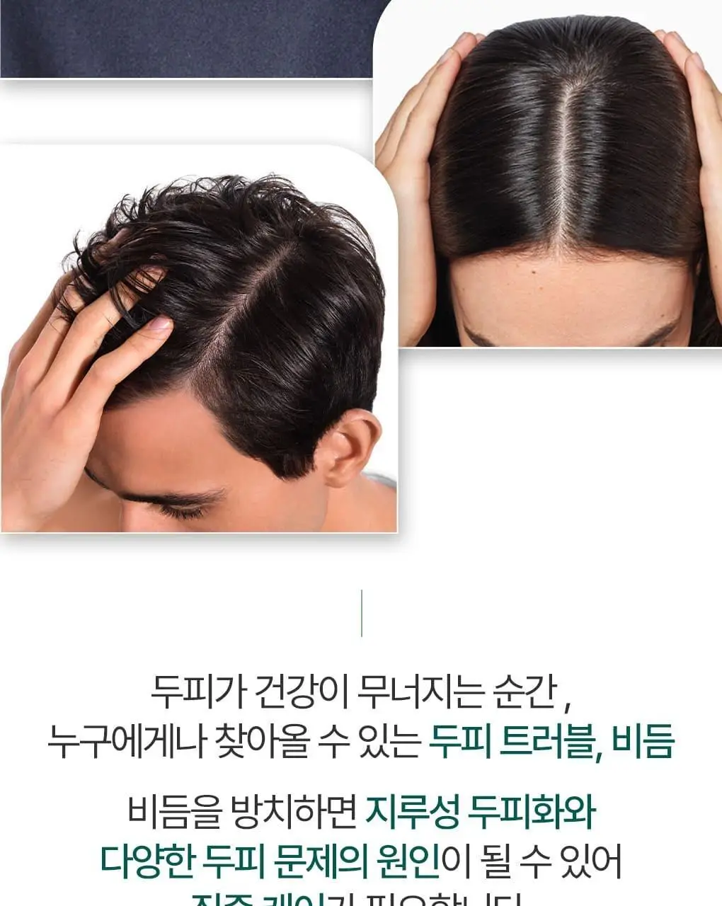 [지루성 두피 & 가려움 케어] 클로란 갈랑가 진저 비듬 앰플 100ml 상세페이지 4